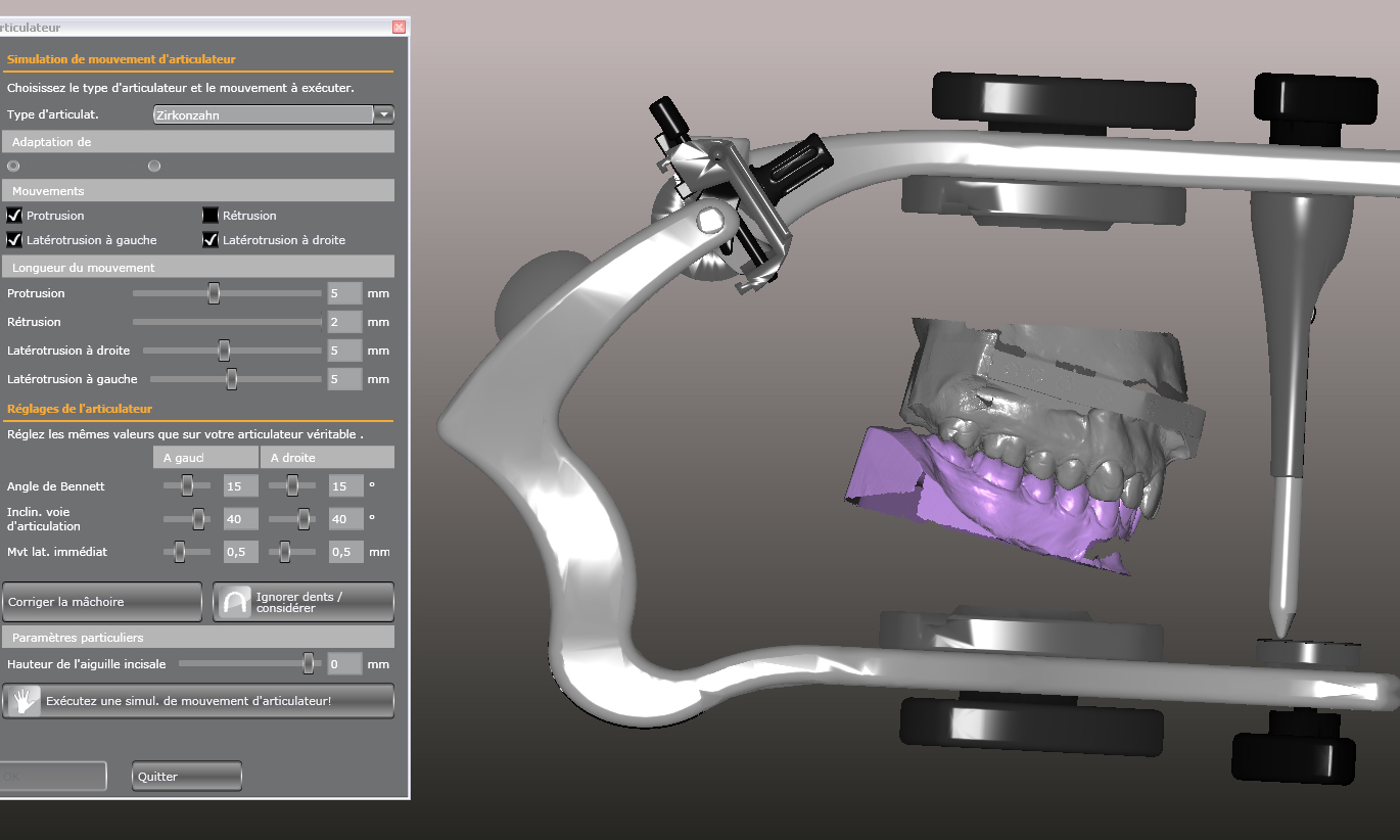 03 - Articulateur virtuel  simulateur mécanique de la bouche de notre patient