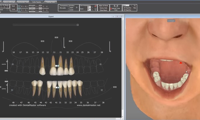 07 - Logiciel Dental Master permettant une modélisation du futur projet prothétique